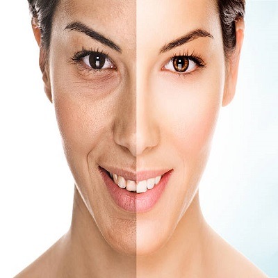 Facelift Surgery in Riyadh for Natural and Youthful Results