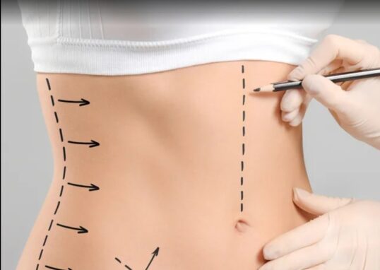 Tummy Tuck In Dubai