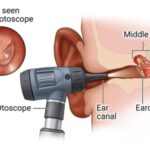 Hearing Screening Gloucester – Protect Your Hearing Health