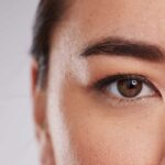Upper blepharoplasty dubai