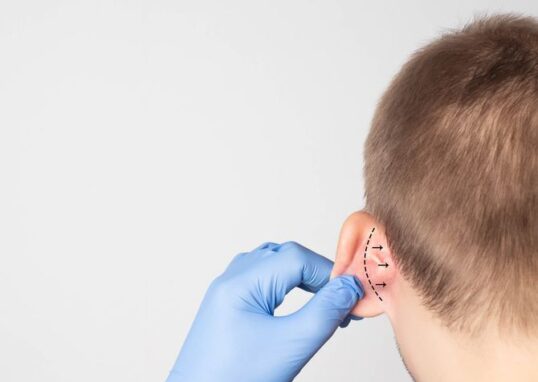 otoplasty in islamabad